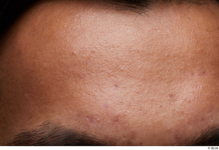 HD Face Skin Ithamar Jung face forehead skin pores skin…
